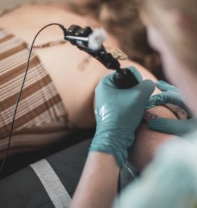basic facts about laser tattoo removal